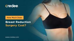 How Much Does Breast Reduction Surgery Cost?