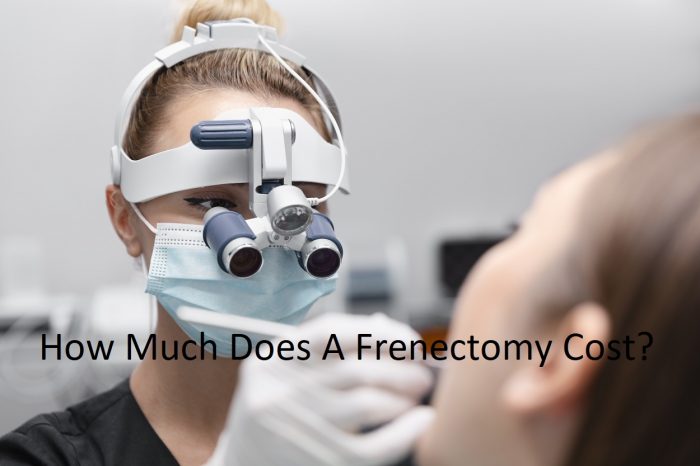 Frenectomy Cost