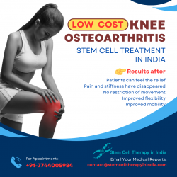 Low Cost Knee Osteoarthritis Stem Cell Treatment In India