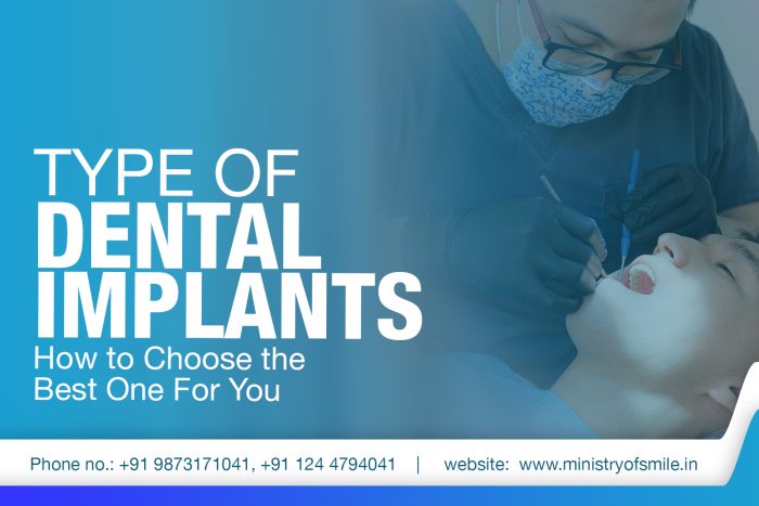 Dental Implants in Gurgaon