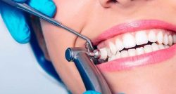 disadvantages of teeth cleaning