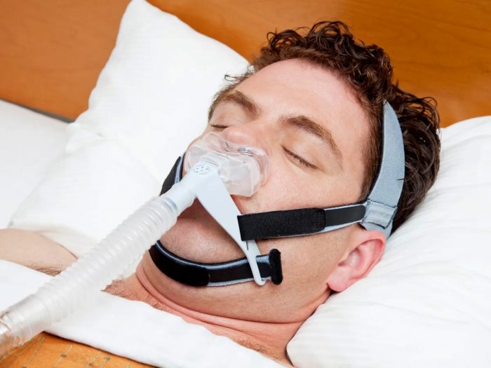 Sleep Apnea Therapy: X Ways to Relieve the Horrible Symptoms