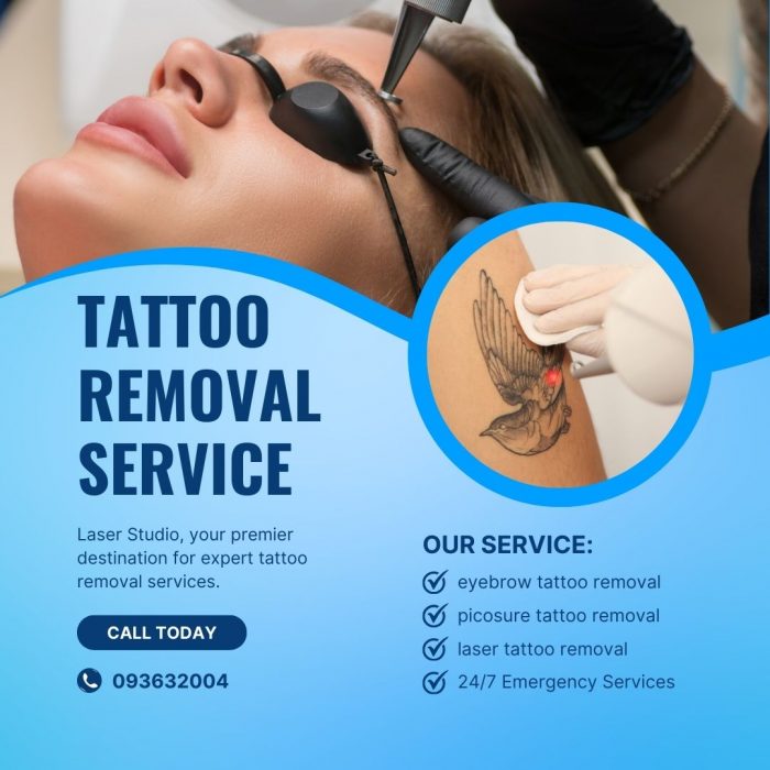 Erase the Past: Effective Tattoo Removal in Auckland