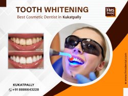 Best Dental Clinic in Kukatpally | Tooth Whitening in Kukatpally