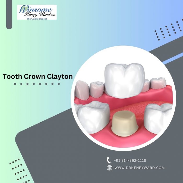 Restore Your Smile with Expert Tooth Crown Services by Dr. Winsome Henry Ward, DMD