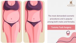 5 Compelling Reasons: Why a Tummy Tuck Surgery Might be for You?