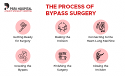 The Complete Process of Bypass Surgery