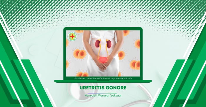 Apa Pengertian dari Penyakit Uretritis Gonore?