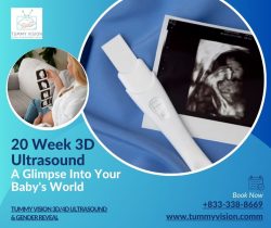 Heartbeats and Hiccups: Life at 20 Weeks in 3D