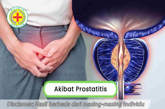 Bukan Masalah Kesehatan Biasa, Kenali 5 Akibat Prostatitis Pria
