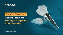 Best Ways To Get Free Dental Implants Through Programs And Charities