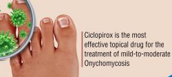 Ciclopirox Nail Lacquer – For Fungal Skin Infections