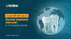 How Much Does All-on-4 Dental Implants Abroad Cost?