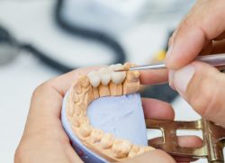 Dental Materials Market to be Worth $8.4 Billion by 2030