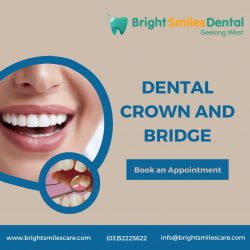 Dental Crown and Bridge | Bright Smiles Dental
