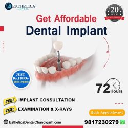 Discover Exceptional Dental Implants in Chandigarh at Esthetica Dental Clinic Mohali