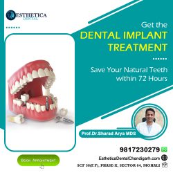 Discover Superior Dental Implants in Mohali at Esthetica Dental Clinic