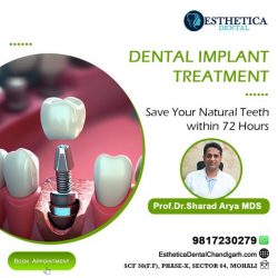 Transform Your Smile: Expert Dental Implants in Tricity by Esthetica Dental Chandigarh