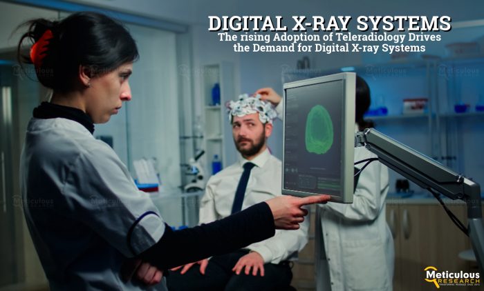 Digital X-ray Systems Market: Technology and Application