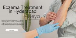 Eczema Treatment in Hyderabad