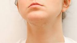 Treatments for Excessive Facial Hair – Eflora Cream