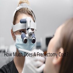much does a frenectomy cost