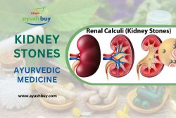 Kidney Stone Ayurvedic Medicine – AyushBuy