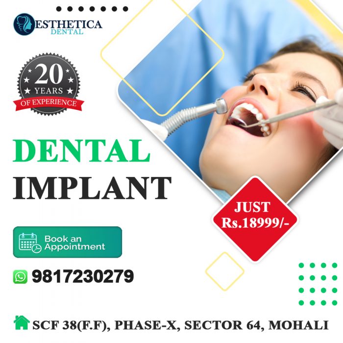 Esthetica Dental Chandigarh – The Best Cheap Dental Implants in Chandigarh
