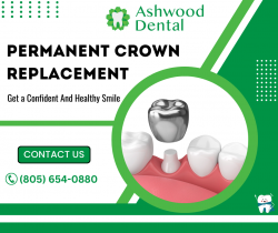 Permanent Crowns of Dental Perfection