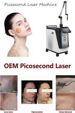 Everything you need to know about picosecond laser technology