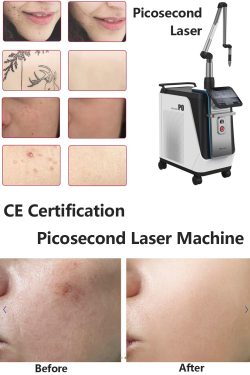 What is picosecond laser skin repair?