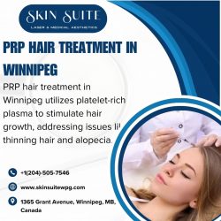 PRP Hair Treatment in Winnipeg