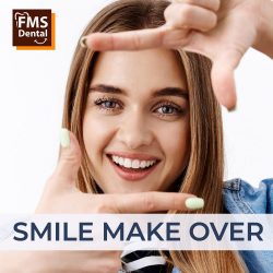 Best Smile Makeover Clinic in Hyderabad, India | Cosmetic Dentistry