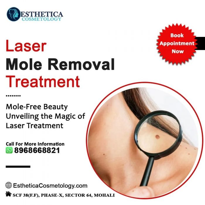 Efficient Mole Removal Services in Mohali at Esthetica Cosmetology Clinic