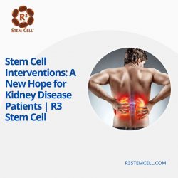 Stem Cell Interventions: A New Hope for Kidney Disease Patients | R3 Stem Cell