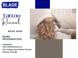 Tattoo Removal | Blade Beauty Boutique