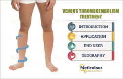 Venous Thromboembolism Treatment Market by Size, Share, Forecast, & Trends Analysis