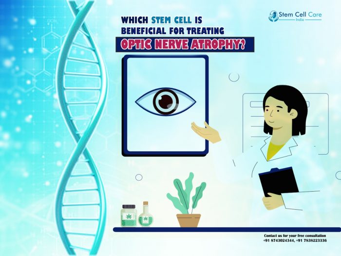 Which Stem Cell is Beneficial for Treating Optic Nerve Atrophy?
