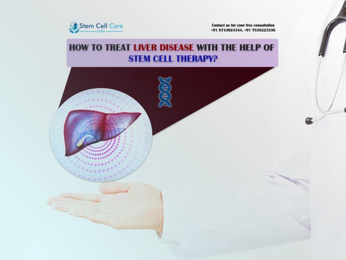 How to Treat Liver Disease with the Help of Stem Cell Therapy?
