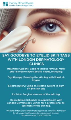 Say Goodbye to Eyelid Skin Tags with London Dermatology Clinics