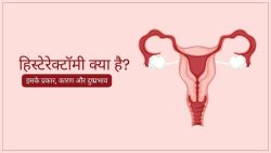 Hysterectomy Meaning in Hindi | Hysterectomy Surgery in Hindi