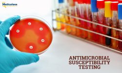 Antimicrobial Susceptibility: Reference Range, Interpretation, Collection and Panels