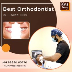 Get Your perfect braces from the Best Orthodontist in Jubilee Hills, Hyderabad
