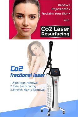 Reasons why CO2 laser is the best for skin rejuvenation