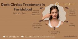 Dark Circles Treatment in Faridabad