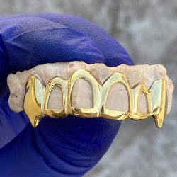 Best Gold Teeth in Dubai