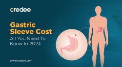 Gastric Sleeve Surgery Cost: All You Need to Know in 2024