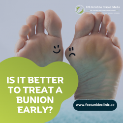 Is it better to treat a bunion early?