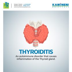 Kamineni Hospital: Thyroiditis Awareness Campaign Submission