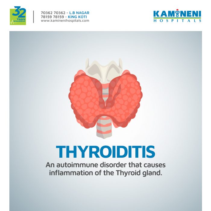 Kamineni Hospital: Thyroiditis Awareness Campaign Submission